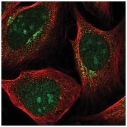 Pyruvate Dehydrogenase Kinase 1/PDK1 Antibody, Novus Biologicals 25 &mu;L,