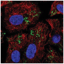 PEDFR/PNPLA2/ATGL Antibody, Novus Biologicals:Antibodies:Primary Antibodies