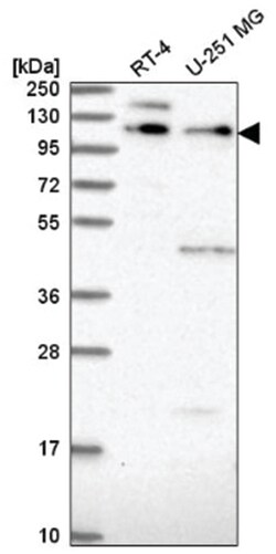 PEPP2 Antibody, Novus Biologicals 100&mu;L; Unlabeled:Antibodies, Polyclonal