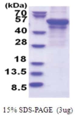 Novus Biologicals Recombinant Human Perilipin-2/ADFP Protein 0.5 mg | Buy Online | Novus Biologicals&trade; | Fisher Scientific