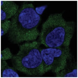 PERQ2 Antibody, Novus Biologicals 25 &mu;L, Unlabeled:Antibodies, Polyclonal