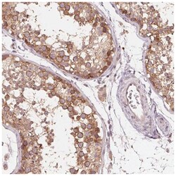 PERQ2 Antibody, Novus Biologicals:Antibodies:Primary Antibodies