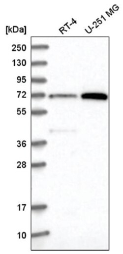 Pescadillo Antibody, Novus Biologicals 25 &mu;L:Antibodies, Polyclonal