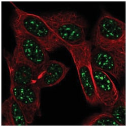 Pet1 Rabbit anti-Human, Polyclonal, Novus Biologicals 100&mu;L; Unlabeled:Antibodies,