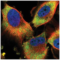 PFDN2 Antibody, Novus Biologicals 100&mu;L; Unlabeled:Antibodies, Polyclonal