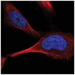 PFKFB4 Antibody, Novus Biologicals 100 &mu;L | Buy Online | Novus Biologicals | Fisher Scientific