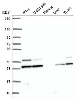 PGAM1 Antibody, Novus Biologicals:Antibodies:Primary Antibodies
