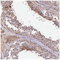 PGK1 Antibody, Novus Biologicals 100&mu;L; Unlabeled:Antibodies, Polyclonal