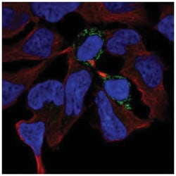PGM2L1 Antibody, Novus Biologicals 100&mu;L; Unlabeled:Antibodies, Polyclonal