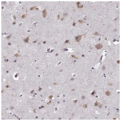 phakinin Antibody, Novus Biologicals 25 &mu;L, Unlabeled:Antibodies, Polyclonal