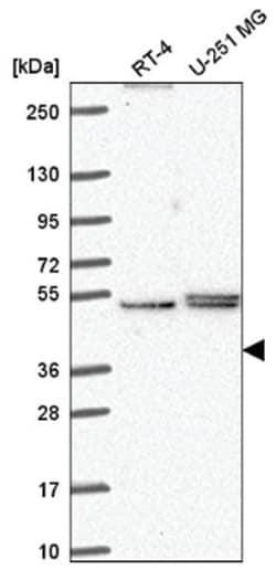 PHAX Antibody, Novus Biologicals 100&mu;L; Unlabeled:Antibodies, Polyclonal