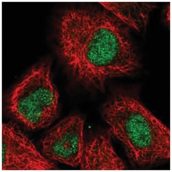 PHC3 Antibody, Novus Biologicals 100&mu;L; Unlabeled:Antibodies, Polyclonal