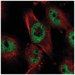 PHF15 Antibody, Novus Biologicals 100&mu;L; Unlabeled:Antibodies, Polyclonal