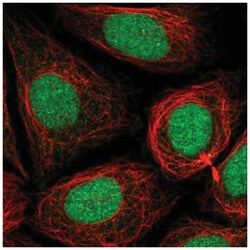 PHF8 Antibody, Novus Biologicals 25 &mu;L:Antibodies, Polyclonal