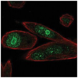 PHLDA1 Antibody, Novus Biologicals 25 &mu;L, Unlabeled:Antibodies, Polyclonal