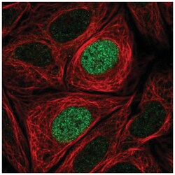 PHLDB1 Antibody, Novus Biologicals 25 &mu;L, Unlabeled:Antibodies, Polyclonal