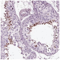Phosducin Antibody, Novus Biologicals 25 &mu;L, Unlabeled:Antibodies, Polyclonal