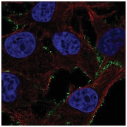 Phosphodiesterase 4A/PDE4A Antibody, Novus Biologicals 25 &mu;L; Unconjugated:Antibodies,