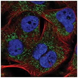 PHYHIP Antibody, Novus Biologicals 25 &mu;L, Unlabeled:Antibodies, Polyclonal