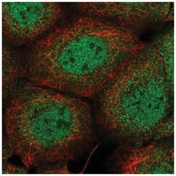 PI 3-Kinase C2 beta Antibody, Novus Biologicals 100&mu;L; Unlabeled:Antibodies,