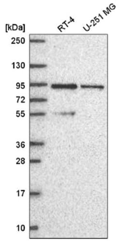 PI 3-Kinase p85 beta Antibody, Novus Biologicals 100&mu;L; Unlabeled:Antibodies,