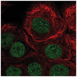 PIAS3 Antibody, Novus Biologicals 25 &mu;L, Unlabeled:Antibodies, Polyclonal