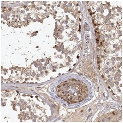 PICK1 Antibody, Novus Biologicals:Antibodies:Primary Antibodies