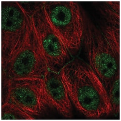 PIK4CA Antibody, Novus Biologicals:Antibodies:Primary Antibodies