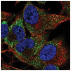 PIM3 Antibody, Novus Biologicals 25 &mu;L:Antibodies, Polyclonal