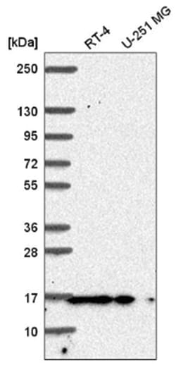 Pin1 Antibody, Novus Biologicals:Antibodies:Primary Antibodies