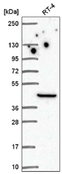 PINCH1/LIMS1 Antibody, Novus Biologicals 100&mu;L; Unlabeled:Antibodies,