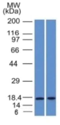 PIP Mouse anti-Human, Clone-PIP/1571, Novus Biologicals 100&mu;g; Unlabeled:Antibodies,