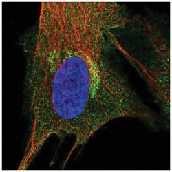 PIP5K2 alpha Antibody, Novus Biologicals:Antibodies:Primary Antibodies