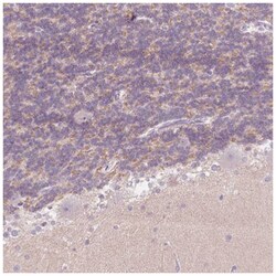 Pit1 Antibody, Novus Biologicals 25 &mu;L:Antibodies, Polyclonal