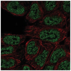 PKC beta Antibody, Novus Biologicals 25 &mu;L:Antibodies, Polyclonal