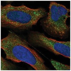 PKC epsilon Antibody, Novus Biologicals 100&mu;L; Unlabeled:Antibodies,