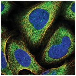 PKC iota Antibody, Novus Biologicals 100&mu;L; Unlabeled:Antibodies, Polyclonal