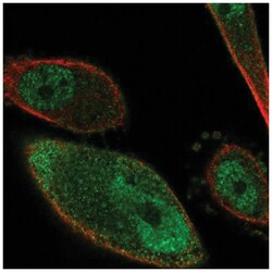 PKIG Antibody, Novus Biologicals:Antibodies:Primary Antibodies