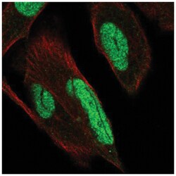 PKNOX1 Antibody, Novus Biologicals 25 &mu;L, Unlabeled:Antibodies, Polyclonal