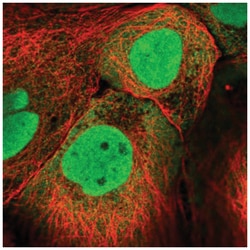 PKNOX1 Antibody, Novus Biologicals 25 &mu;L, Unlabeled:Antibodies, Polyclonal
