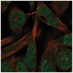 PKNOX2 Antibody, Novus Biologicals 25 &mu;L:Antibodies, Polyclonal