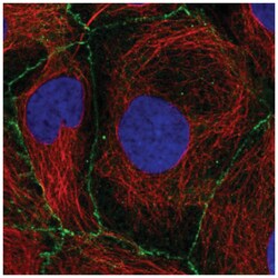 Plakophilin 2 Antibody, Novus Biologicals:Antibodies:Primary Antibodies