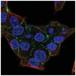 Plakophilin 4 Antibody, Novus Biologicals 25 &mu;L:Antibodies, Polyclonal