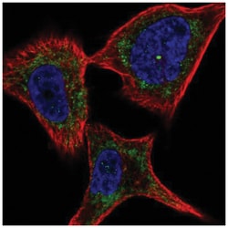 Plexin C1 Antibody, Novus Biologicals 100&mu;L; Unlabeled:Antibodies, Polyclonal