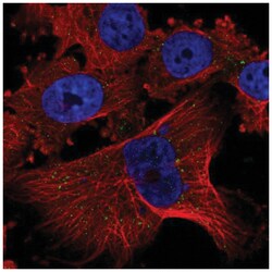 PLGLB1 Antibody, Novus Biologicals 100&mu;L; Unlabeled:Antibodies, Polyclonal