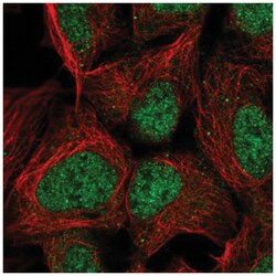 PMF1 Antibody, Novus Biologicals 25 &mu;L, Unlabeled:Antibodies, Polyclonal