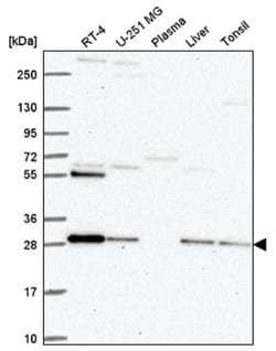 PMM2/Phosphomannomutase 2 Antibody, Novus Biologicals:Antibodies:Primary