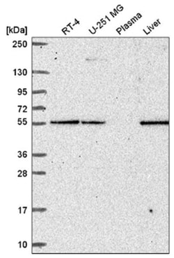 PMPCA Antibody, Novus Biologicals 100&mu;L; Unlabeled:Antibodies, Polyclonal