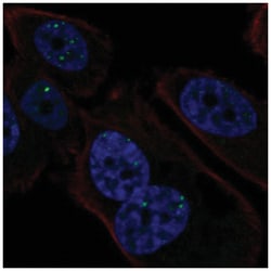 PMS1 Antibody, Novus Biologicals 25 &mu;L, Unlabeled:Antibodies, Polyclonal