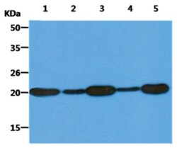 PMVK/phosphomevalonate kinase Mouse anti-Human, Clone: 21C10, Novus Biologicals